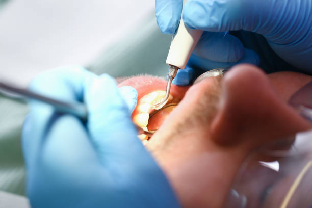 Best Broken or Cracked Tooth Emergency Dentist in Trenton, OH