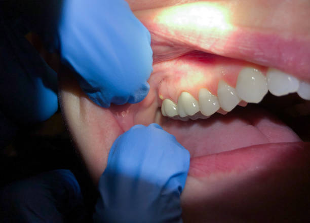 Best Orthodontic Emergency Dentist in Trenton, OH